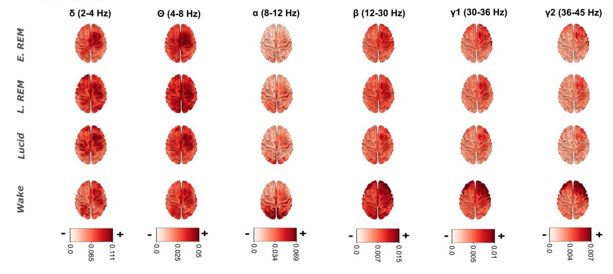 Le cerveau d’un rêveur lucide n’est-il ni endormi ni éveillé ?